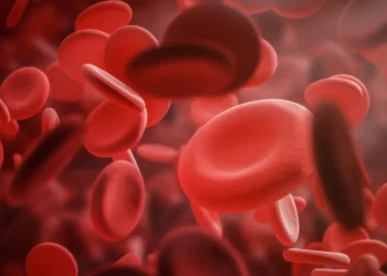 anemia, com microcitose, palidez, desordem, hereditária;