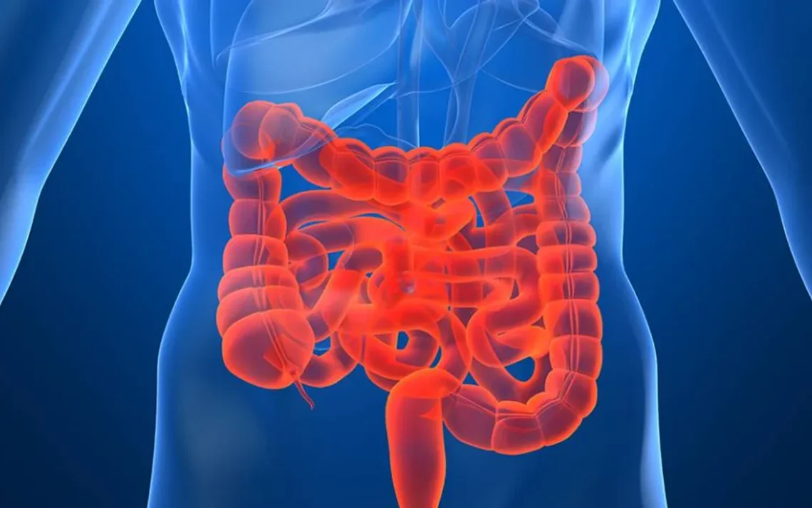 DOENÇA INFLAMATÓRIA: Condição pode levar a danos no revestimento do cólon, parte do intestino grosso (Ilustração: iStock/iStock) - Todos os direitos: @ Veja Abril